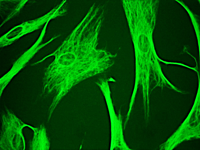 Figure 1. Indirect immunofluorescence staining of normal human dermal fibroblasts in tissue culture with MUB1904P (diluted 1:100), showing the specific cytoskeletal pattern of vimentin intermediate filaments.
